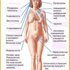 Symptomy a příznaky hypertyreózy