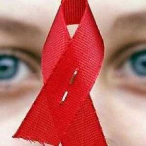 Příznaky HIV