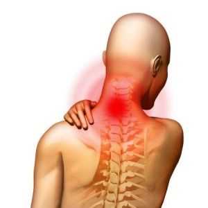 Syndrom vertebrální tepny: definice, příznaky, léčba, rizikové skupiny