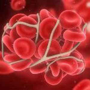 Tromboembolismu nádoby a její důsledky