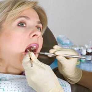 Odstranění zubního kamene ultrazvukem