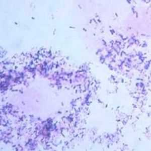 Ureaplasma urealitikum (Ureaplasma urealyticum): co to je a co dělat, když je zjištěna infekce v…