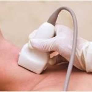 Štítné žlázy ultrazvuk - řádná příprava ultrazvukové studie
