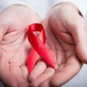 HIV infekce: příznaky u žen a prognóza po ošetření