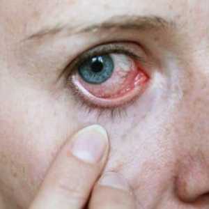 Vitamin kapky pro únavu a zarudnutí očí