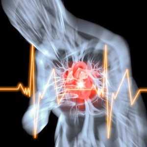 Náhlá smrt srdeční způsobuje akutní koronární nedostatečnosti a další