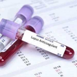 Lupus anticoagulant: jeden najde, co je nebezpečné, a míra odmítnutí, léčba