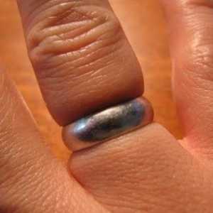 Všechny metody odstraňování prsten s oteklý prst