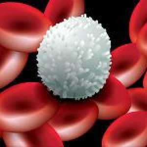 Co bílé krvinky a co způsobilo změnu v jejich hladiny v krvi?