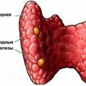 Onemocnění endokrinního systému hyperparatyreózy, symptomů a léčení