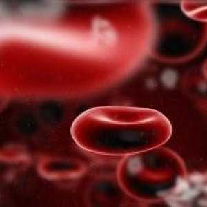 Krevní poruchy: seznam nejčastějších a nejzávažnějších chorob