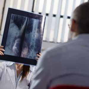 Proč je x-ray žaludku s baryum?