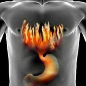 Žluči v žaludku: příčiny a různé způsoby léčby této nemoci
