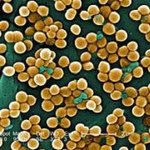 Staphylococcus aureus v krku